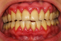 Témoignage Peur du Dentiste